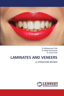 Laminates and Veneers 6208117348 Book Cover