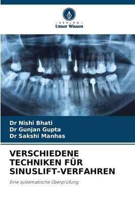 Verschiedene Techniken Für Sinuslift-Verfahren [German] 6209563783 Book Cover