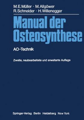 Manual Der Osteosynthese: Ao-Technik [German] 3642963838 Book Cover