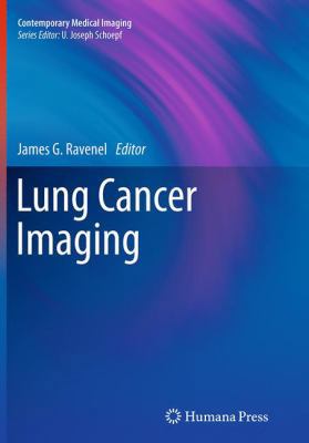 Lung Cancer Imaging 1493940686 Book Cover