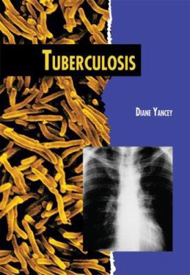 Tuberculosis 0822591901 Book Cover