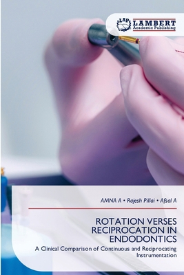Rotation Verses Reciprocation in Endodontics 663017271X Book Cover