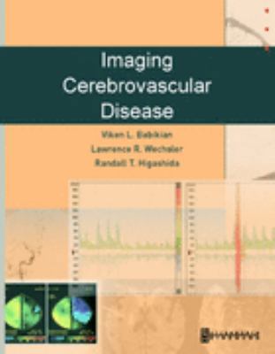 Imaging Cerebrovascular Disease 0750673028 Book Cover