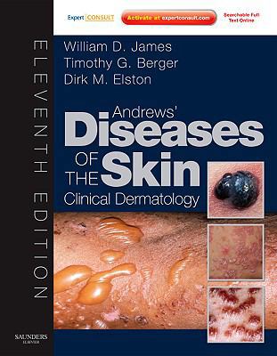 Andrews' Diseases of the Skin: Clinical Dermatology