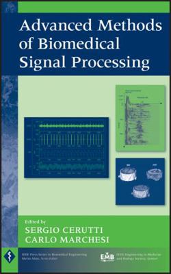 Biomedical Signal Processing 0470422149 Book Cover