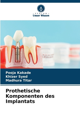 Prothetische Komponenten des Implantats [German] 6208501504 Book Cover