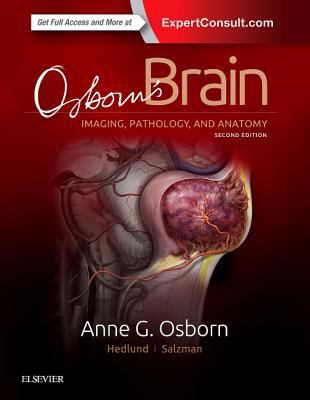 Osborn's Brain 0323477763 Book Cover