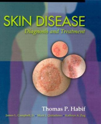 Skin Disease: Diagnosis and Treatment 0815137621 Book Cover