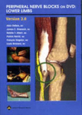 Peripheral Nerve Blocks on Dvd: Lower Limbs 0781743397 Book Cover