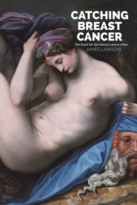 Catching Breast Cancer 139844782X Book Cover