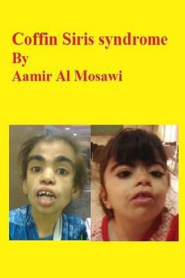 Coffin Siris syndrome: Clinical genetics 1729822800 Book Cover