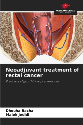 Neoadjuvant treatment of rectal cancer 6208496578 Book Cover