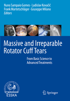 Massive and Irreparable Rotator Cuff Tears: Fro... 3662611643 Book Cover