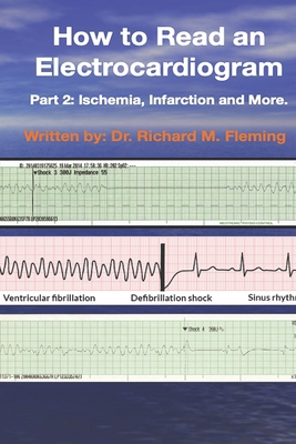 How to Read an Electrocardiogram: Part 2: Ische... B08NVDLP1V Book Cover