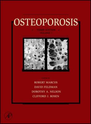 Osteoporosis 0123705452 Book Cover