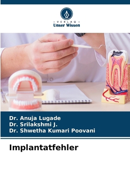 Implantatfehler [German] 6207967437 Book Cover