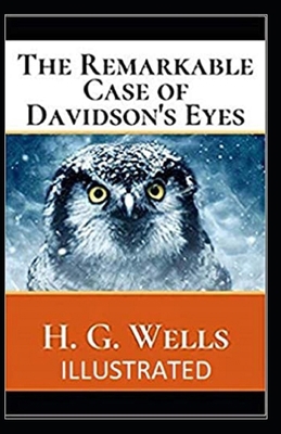 Paperback The Remarkable Case of Davidsons Eyes Illustrated Book