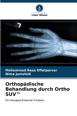 Orthopädische Behandlung durch Ortho SUV(TM) [German] B0CL8BJT97 Book Cover