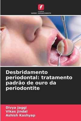 Desbridamento periodontal: tratamento padrão de... [Portuguese] 620850693X Book Cover