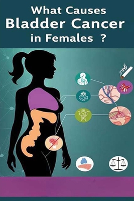 What Causes Bladder Cancer in Females?: There a... B0DBZG32ML Book Cover
