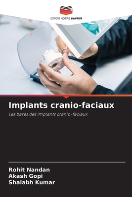 Implants cranio-faciaux [French] 6209888003 Book Cover