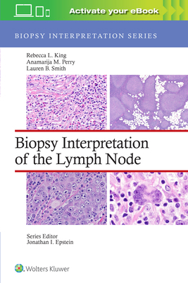 Biopsy Interpretation of the Lymph Node: Print ... 1975184629 Book Cover