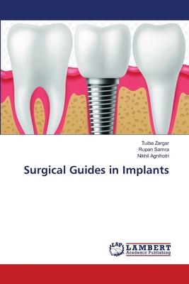 Surgical Guides in Implants 6209998933 Book Cover