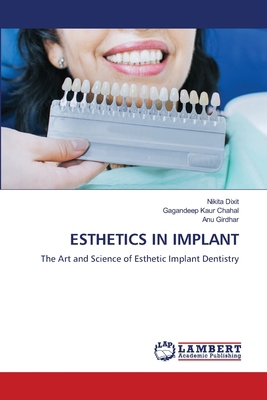Esthetics in Implant 6208427975 Book Cover