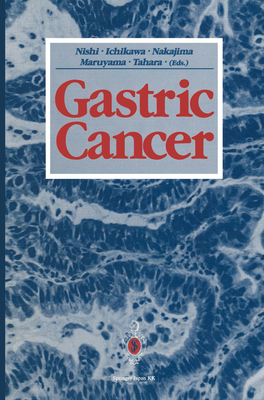 Gastric Cancer 4431683305 Book Cover
