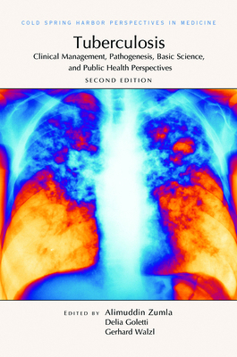 Tuberculosis: Clinical Management, Pathogenesis... 162182540X Book Cover
