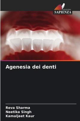 Agenesia dei denti [Italian] 6207757955 Book Cover