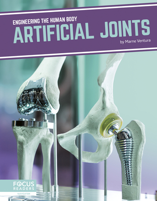 Artificial Joints 1641857617 Book Cover