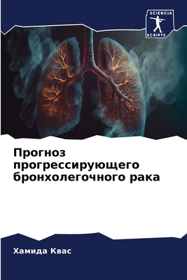 Прогноk... [Russian] 6205964198 Book Cover