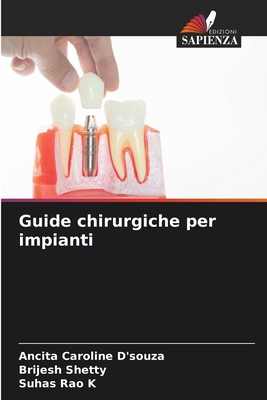 Guide chirurgiche per impianti [Italian] 6208075688 Book Cover