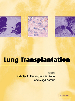 Lung Transplantation 0521036771 Book Cover