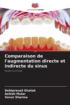 Comparaison de l'augmentation directe et indire... [French] 6207408977 Book Cover