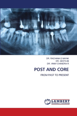 Post and Core 6208428998 Book Cover