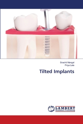 Tilted Implants 6207806891 Book Cover