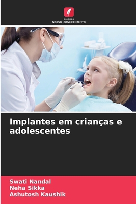 Implantes em crianças e adolescentes [Portuguese] 6208250676 Book Cover