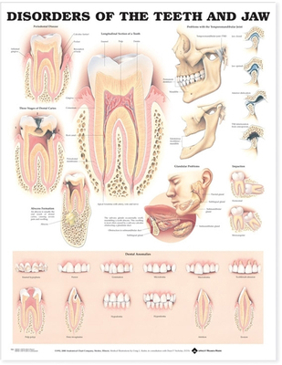 Disorders of the Teeth and Jaw Anatomical Chart 1587792508 Book Cover
