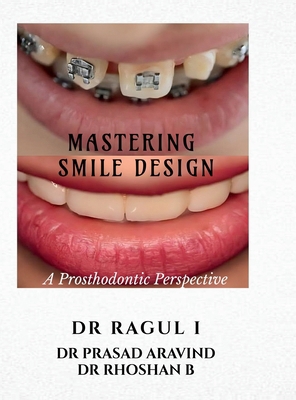 Mastering Smile Design: A Prosthodontic Perspec... B0FL98XZ6F Book Cover
