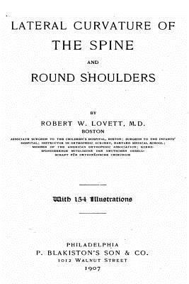 Lateral Curvature of the Spine and Round Shoulders 153506529X Book Cover