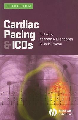 Cardiac Pacing and ICDs B00BG7DU9O Book Cover