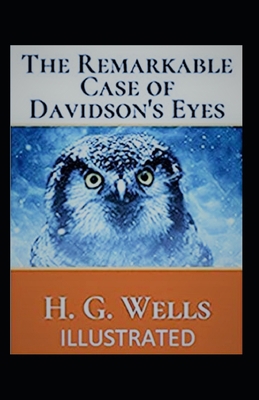 Paperback The Remarkable Case of Davidsons Eyes Illustrated Book