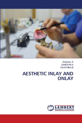 Aesthetic Inlay and Onlay 6207484967 Book Cover