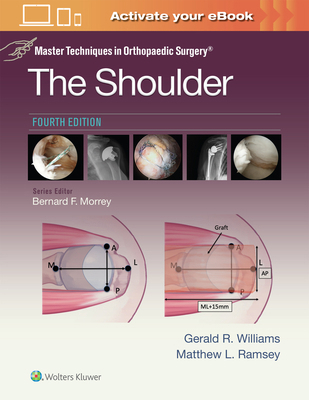 Master Techniques in Orthopaedic Surgery: The S... 1975217969 Book Cover