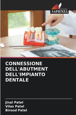 Connessione Dell'abutment Dell'impianto Dentale [Italian] 6207763769 Book Cover