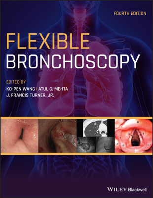 Flexible Bronchoscopy 1119389054 Book Cover