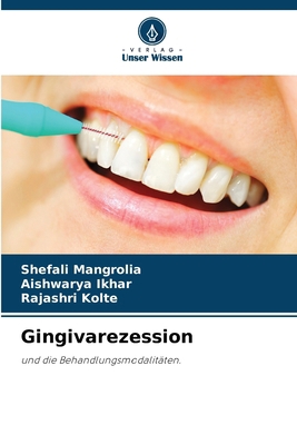 Gingivarezession [German] 6208006031 Book Cover