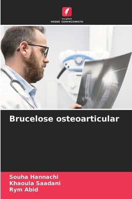Brucelose osteoarticular [Portuguese] 6207682890 Book Cover